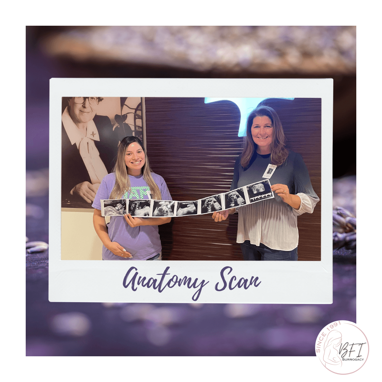 WHAT IS ANATOMY SCAN visual data 3